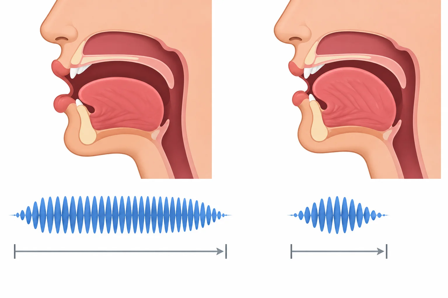 Dois perfis de boca lado a lado mostram uma vogal sustentada por mais tempo e outra mais curta, com linhas sonoras de comprimentos diferentes.