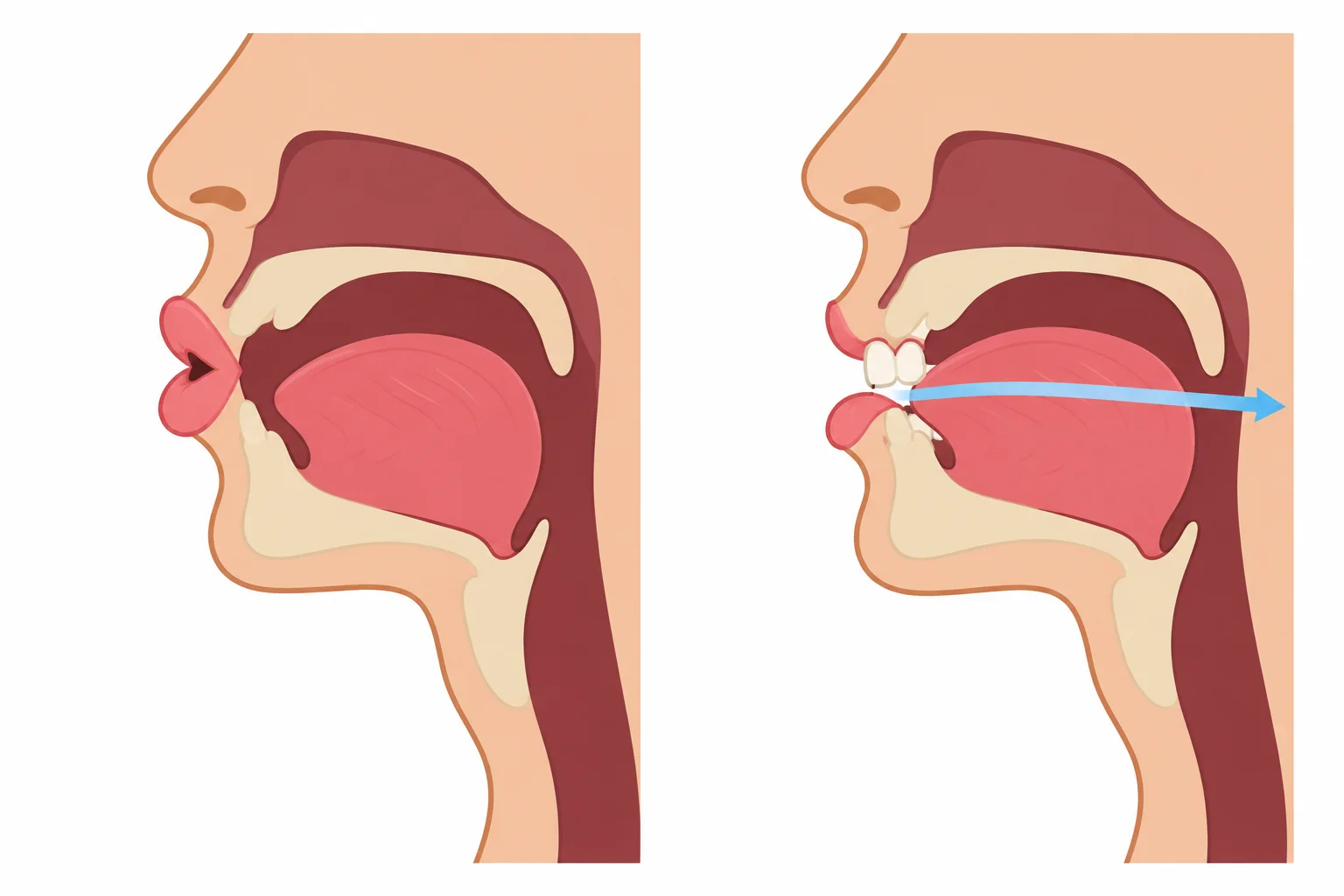 Comparação lateral da boca: lábios arredondados sem contato dentário para /w/ e dentes superiores tocando levemente o lábio inferior para /v/.