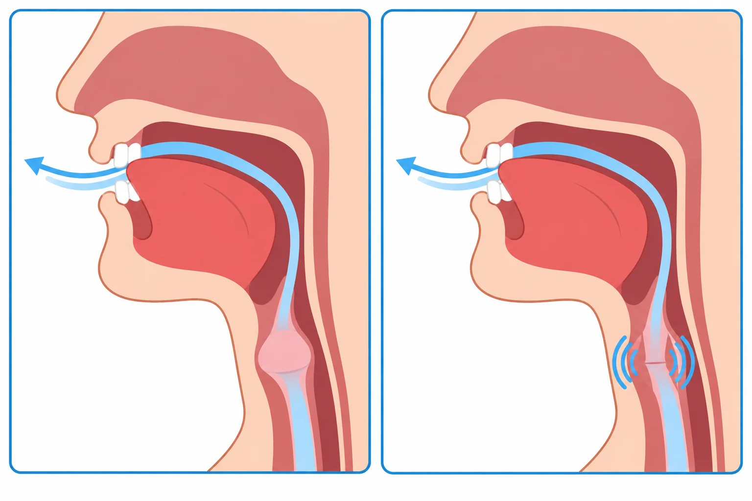 Diagrama em dois painéis: língua próxima aos dentes e ar passando nos dois sons; apenas o painel da direita mostra ondas de vibração na garganta.