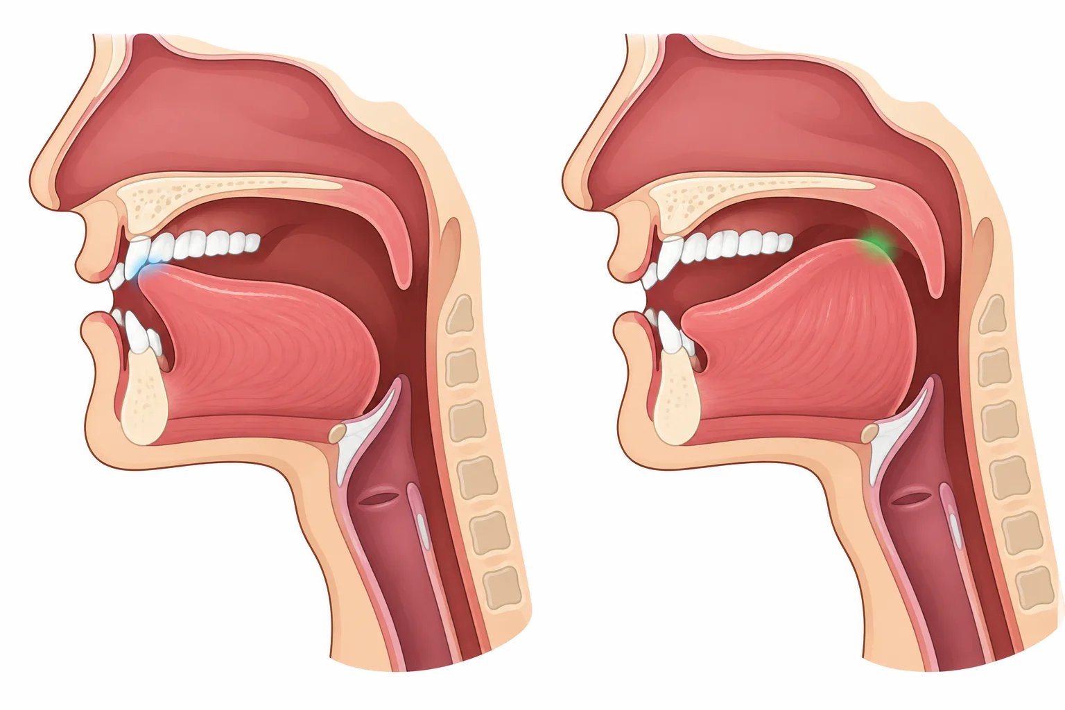 Comparação em corte lateral da boca: a ponta da língua toca atrás dos dentes superiores para /t/; a parte de trás da língua toca o palato mole para /k/.