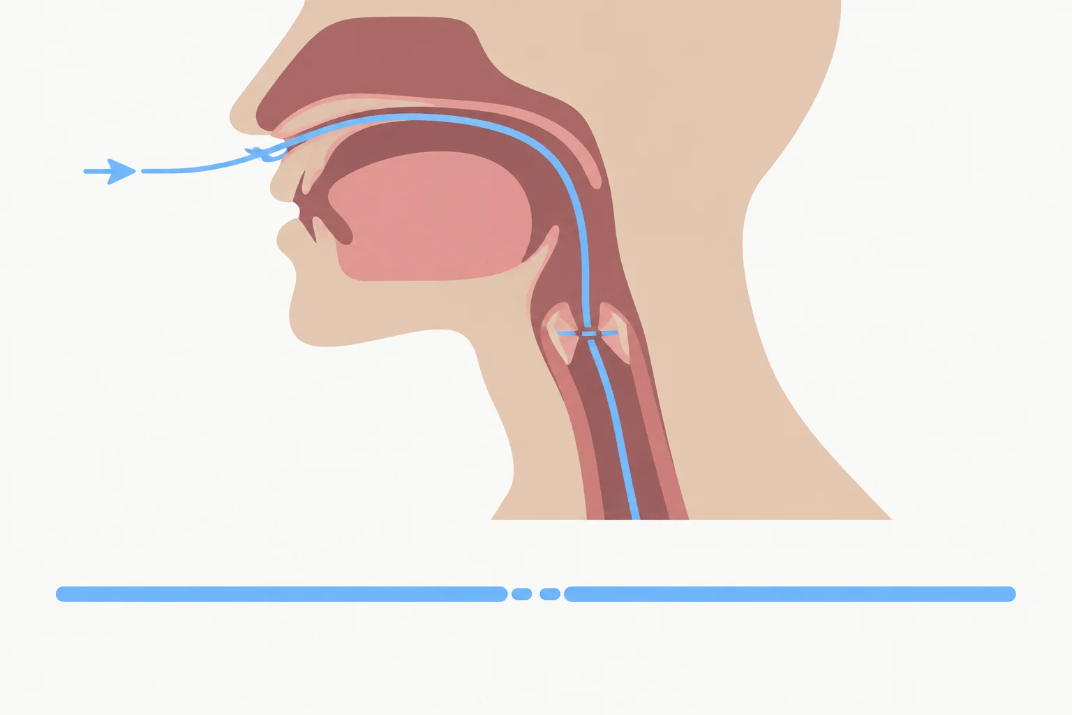 Esquema mostrando o fluxo de ar interrompido brevemente na glote e retomado em seguida.